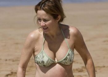 Whoa: Gorgeous Beach Photos of Patricia Healton.Where is her belly button? I had several surgeries when asked about it in an interview with BBC News.